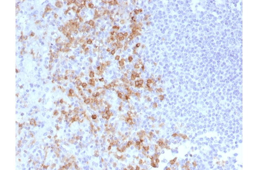 Immunohistochemistry - Anti-CD162 Antibody [PSGL1/1601] - BSA and Azide free (A253131) - Antibodies.com