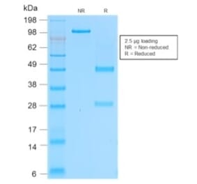 SDS-PAGE - Anti-CD162 Antibody [rPSGL1/1601] - BSA and Azide free (A253132) - Antibodies.com