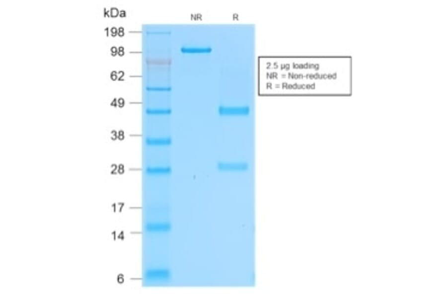 SDS-PAGE - Anti-CD162 Antibody [rPSGL1/1601] - BSA and Azide free (A253132) - Antibodies.com