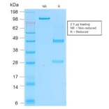 SDS-PAGE - Anti-CD162 Antibody [rPSGL1/1601] - BSA and Azide free (A253132) - Antibodies.com