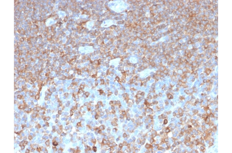 Immunohistochemistry - Anti-gamma Parvin Antibody [PARVG/6312R] - BSA and Azide free (A253135) - Antibodies.com