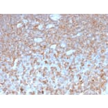 Immunohistochemistry - Anti-gamma Parvin Antibody [PARVG/6312R] - BSA and Azide free (A253135) - Antibodies.com