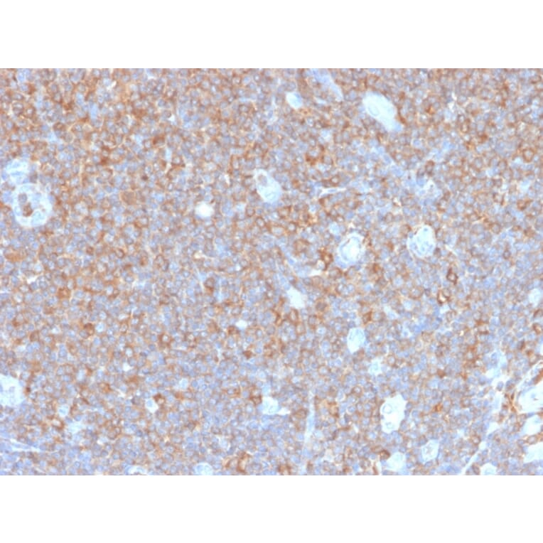 Immunohistochemistry - Anti-gamma Parvin Antibody [PARVG/6312R] - BSA and Azide free (A253133) - Antibodies.com