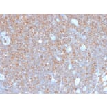 Immunohistochemistry - Anti-gamma Parvin Antibody [PARVG/6312R] - BSA and Azide free (A253133) - Antibodies.com