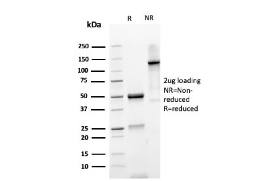 SDS-PAGE - Anti-gamma Parvin Antibody [PARVG/6312R] - BSA and Azide free (A253135) - Antibodies.com