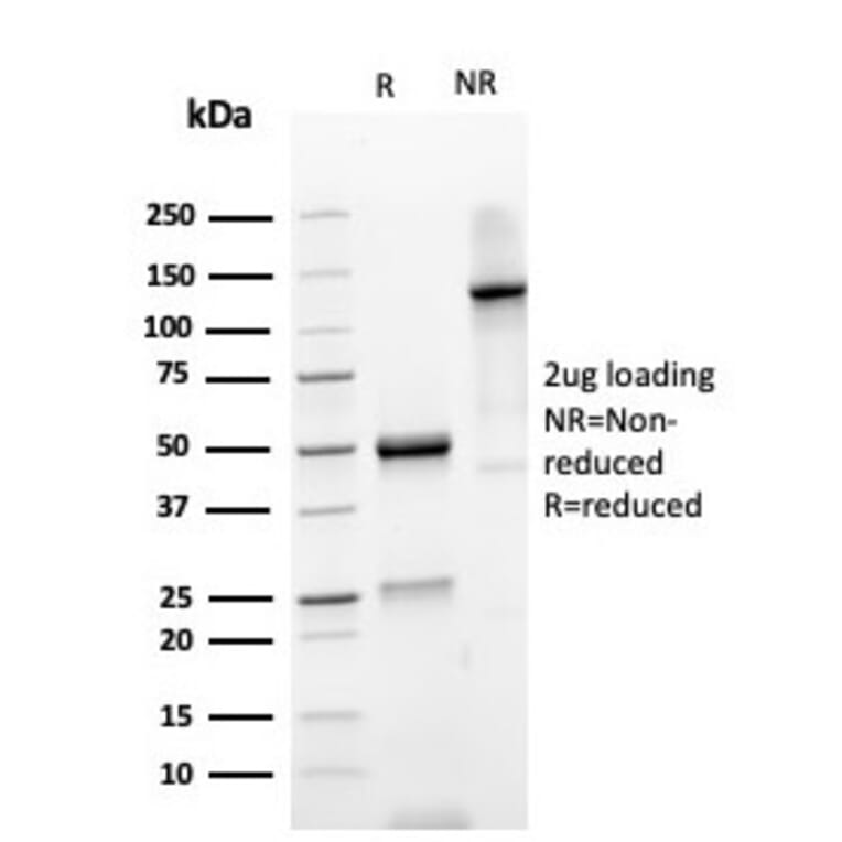 SDS-PAGE - Anti-gamma Parvin Antibody [PARVG/6312R] - BSA and Azide free (A253135) - Antibodies.com