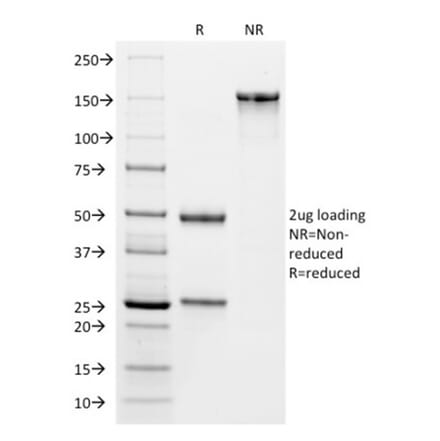 SDS-PAGE - Anti-VISTA Antibody [VISTA/2864] - BSA and Azide free (A253136) - Antibodies.com