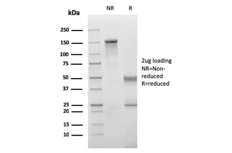 SDS-PAGE - Anti-VISTA Antibody [VISTA/3006] - BSA and Azide free (A253138) - Antibodies.com