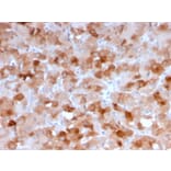 Immunohistochemistry - Anti-VISTA Antibody [VISTA/3007] - BSA and Azide free (A253139) - Antibodies.com