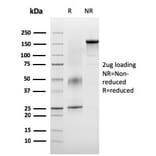SDS-PAGE - Anti-VISTA Antibody [VISTA/3007] - BSA and Azide free (A253139) - Antibodies.com