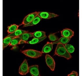 Immunofluorescence - Anti-SET Antibody [PCRP-SET-1C6] - BSA and Azide free (A253140) - Antibodies.com