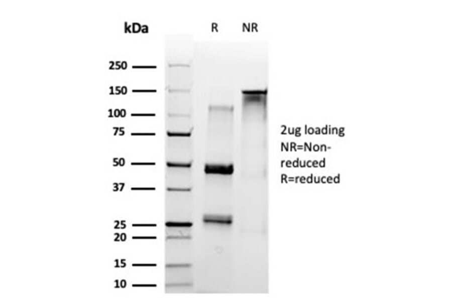 SDS-PAGE - Anti-SET Antibody [PCRP-SET-1C6] - BSA and Azide free (A253140) - Antibodies.com