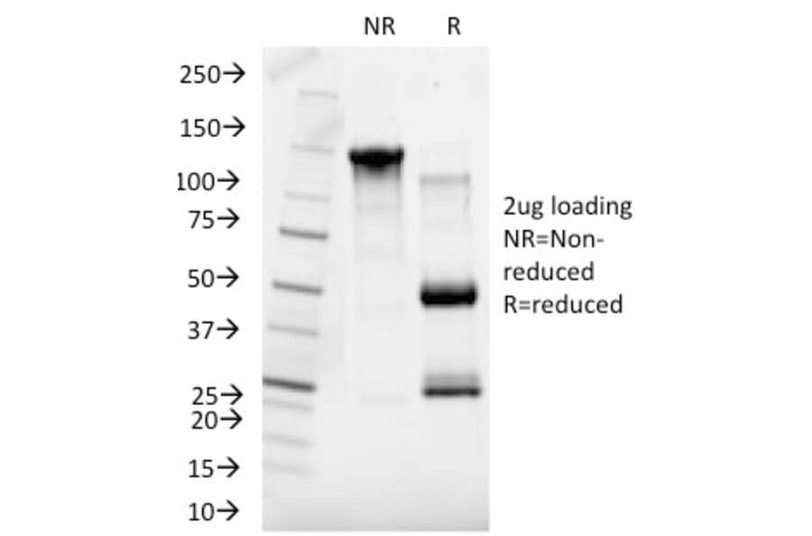 SDS-PAGE - Anti-Sex Hormone Binding Globulin Antibody [SHBG/245] - BSA and Azide free (A253142) - Antibodies.com