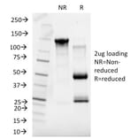 SDS-PAGE - Anti-Sex Hormone Binding Globulin Antibody [SHBG/245] - BSA and Azide free (A253142) - Antibodies.com