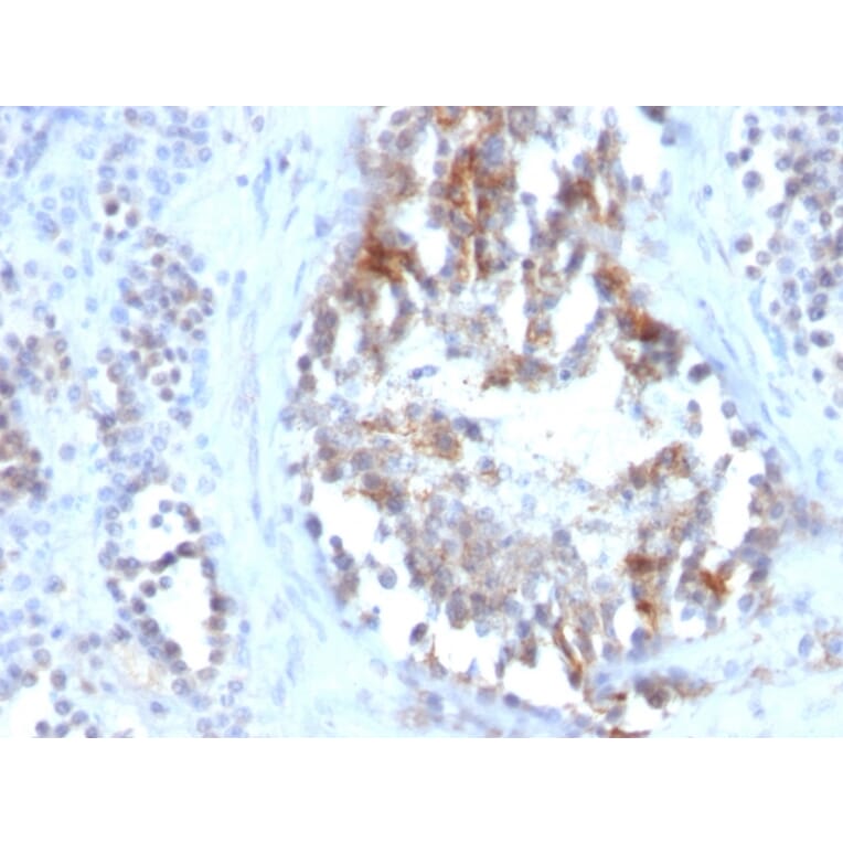 Immunohistochemistry - Anti-Sex Hormone Binding Globulin Antibody [SPM605] - BSA and Azide free (A253142) - Antibodies.com
