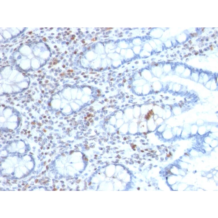 Immunohistochemistry - Anti-BMI1 Antibody [BMI1/2689] - BSA and Azide free (A253144) - Antibodies.com