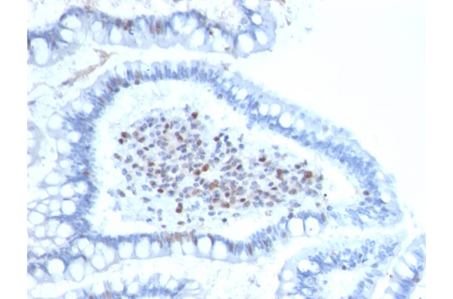 Immunohistochemistry - Anti-BMI1 Antibody [BMI1/2689] - BSA and Azide free (A253144) - Antibodies.com