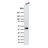 Western Blot - Anti-BMI1 Antibody [BMI1/2689] - BSA and Azide free (A253144) - Antibodies.com
