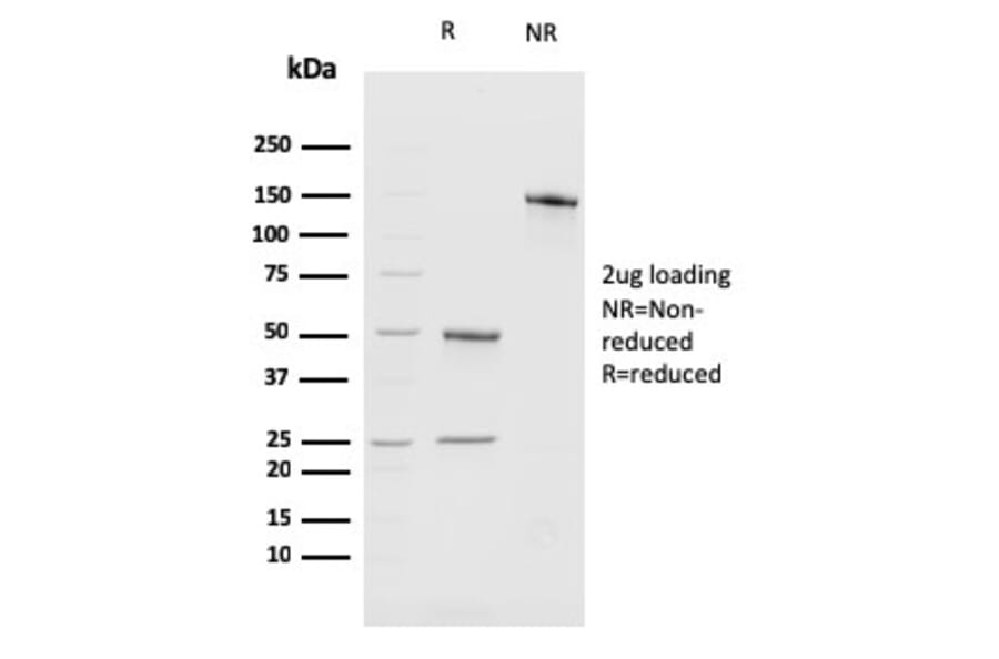 SDS-PAGE - Anti-BMI1 Antibody [BMI1/2689] - BSA and Azide free (A253144) - Antibodies.com