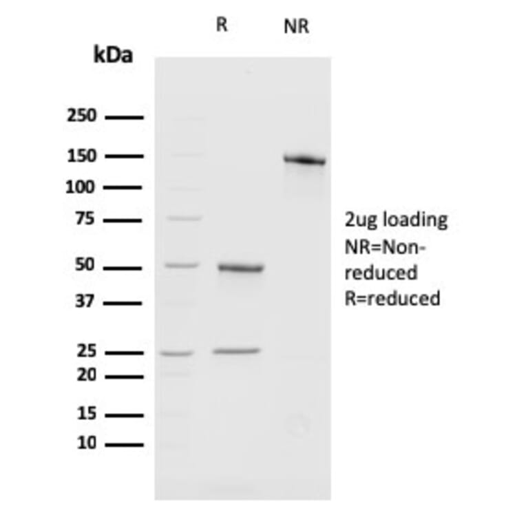 SDS-PAGE - Anti-BMI1 Antibody [BMI1/2689] - BSA and Azide free (A253144) - Antibodies.com