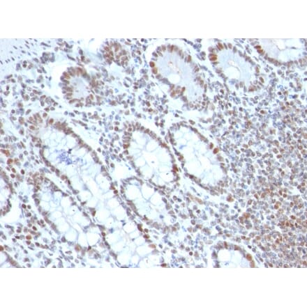 Immunohistochemistry - Anti-BMI1 Antibody [BMI1/2690] - BSA and Azide free (A253145) - Antibodies.com