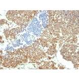 Immunohistochemistry - Anti-BMI1 Antibody [BMI1/2690] - BSA and Azide free (A253145) - Antibodies.com