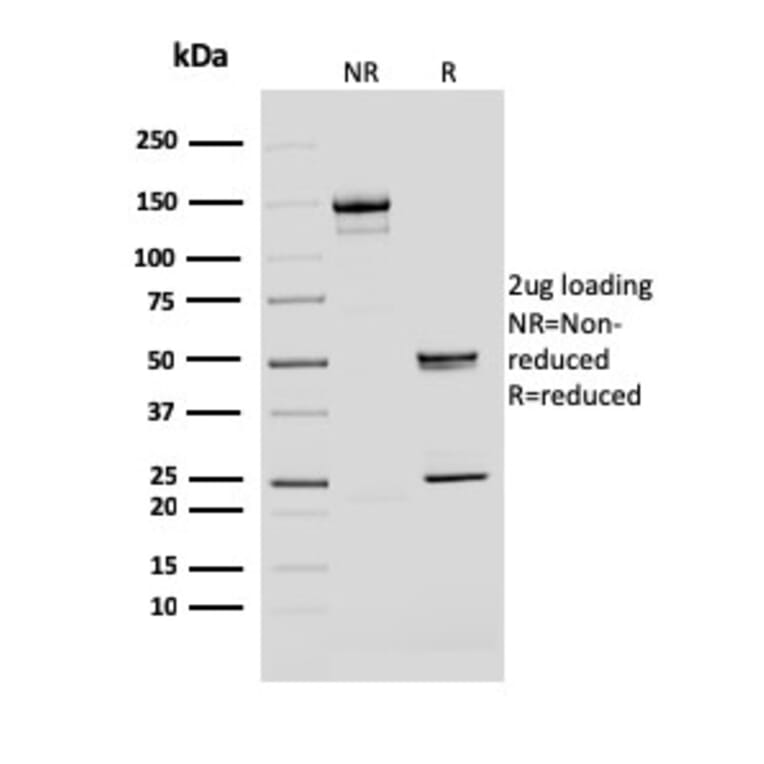 SDS-PAGE - Anti-BMI1 Antibody [BMI1/2690] - BSA and Azide free (A253145) - Antibodies.com