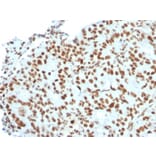 Immunohistochemistry - Anti-BMI1 Antibody [BMI1/2823] - BSA and Azide free (A253146) - Antibodies.com