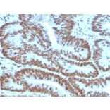 Immunohistochemistry - Anti-BMI1 Antibody [BMI1/2823] - BSA and Azide free (A253146) - Antibodies.com