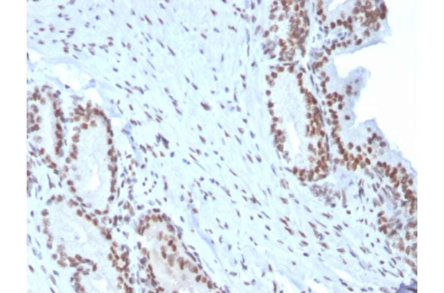 Immunohistochemistry - Anti-BMI1 Antibody [BMI1/2823] - BSA and Azide free (A253146) - Antibodies.com