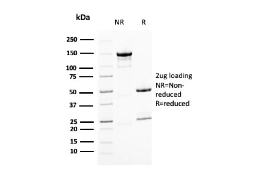 SDS-PAGE - Anti-BMI1 Antibody [BMI1/2823] - BSA and Azide free (A253146) - Antibodies.com