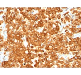 Immunohistochemistry - Anti-Melanoma gp100 Antibody [HMB45] - BSA and Azide free (A253146) - Antibodies.com