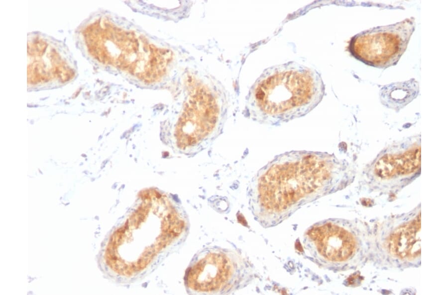 Immunohistochemistry - Anti-Melanoma gp100 Antibody [HMB45] - BSA and Azide free (A253147) - Antibodies.com