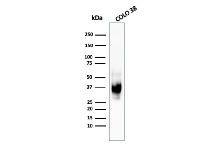 Western Blot - Anti-Melanoma gp100 Antibody [HMB45] - BSA and Azide free (A253147) - Antibodies.com