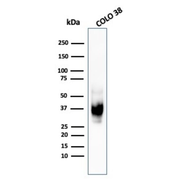 Western Blot - Anti-Melanoma gp100 Antibody [HMB45] - BSA and Azide free (A253147) - Antibodies.com