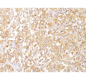 Immunohistochemistry - Anti-Melanoma gp100 Antibody [SPM142] - BSA and Azide free (A253148) - Antibodies.com