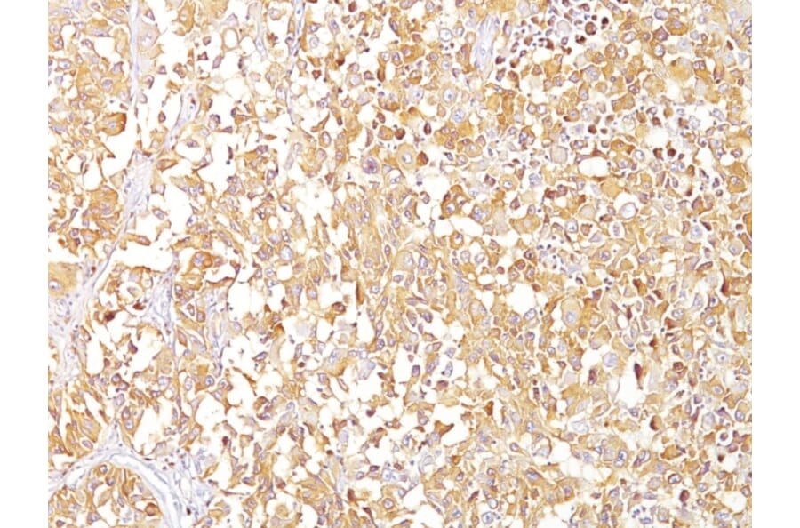 Immunohistochemistry - Anti-Melanoma gp100 Antibody [SPM142] - BSA and Azide free (A253148) - Antibodies.com