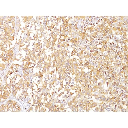 Immunohistochemistry - Anti-Melanoma gp100 Antibody [SPM142] - BSA and Azide free (A253148) - Antibodies.com