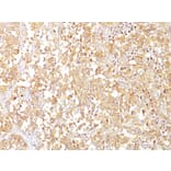 Immunohistochemistry - Anti-Melanoma gp100 Antibody [SPM142] - BSA and Azide free (A253148) - Antibodies.com