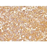 Immunohistochemistry - Anti-Melanoma gp100 Antibody [SPM142] - BSA and Azide free (A253147) - Antibodies.com