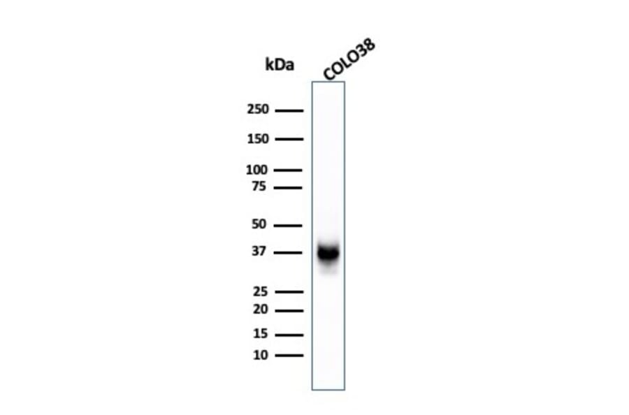 Western Blot - Anti-Melanoma gp100 Antibody [SPM142] - BSA and Azide free (A253148) - Antibodies.com