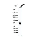 Western Blot - Anti-Melanoma gp100 Antibody [SPM142] - BSA and Azide free (A253148) - Antibodies.com