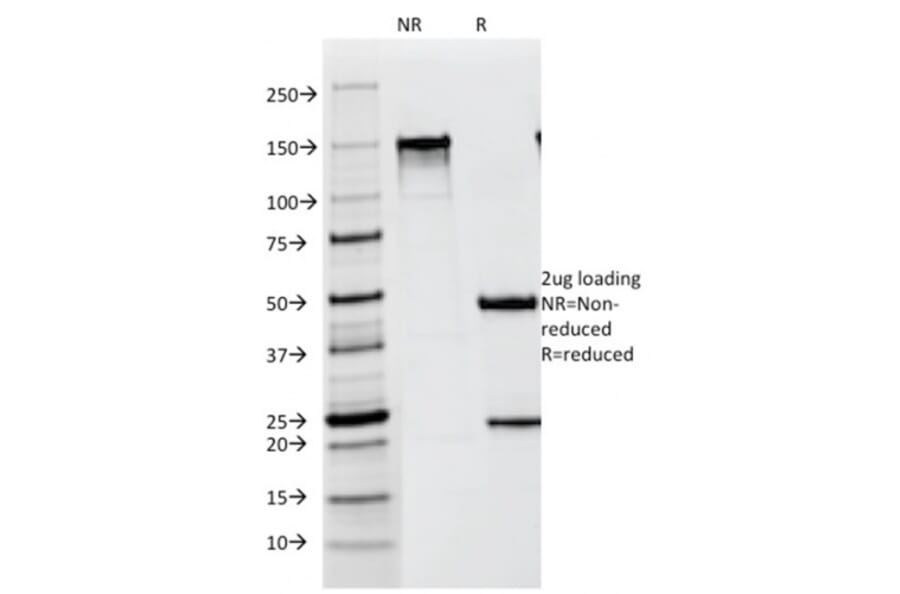 SDS-PAGE - Anti-Melanoma gp100 Antibody [NKI-beteb] - BSA and Azide free (A253149) - Antibodies.com