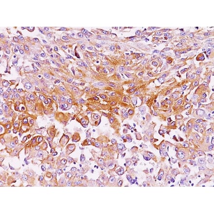 Immunohistochemistry - Anti-Melanoma gp100 Antibody [SPM286] - BSA and Azide free (A253149) - Antibodies.com