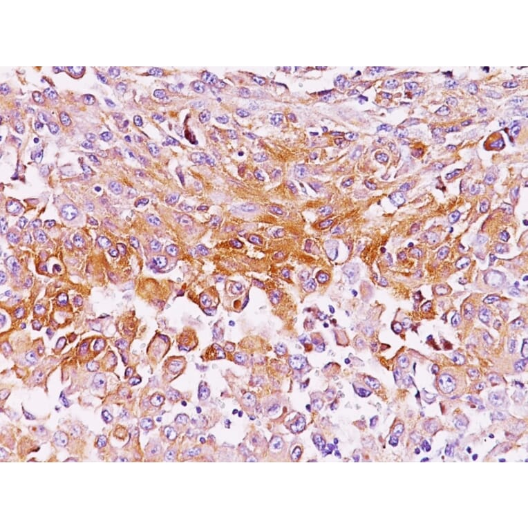 Immunohistochemistry - Anti-Melanoma gp100 Antibody [SPM286] - BSA and Azide free (A253149) - Antibodies.com