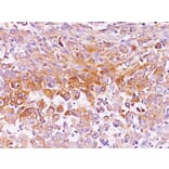 Immunohistochemistry - Anti-Melanoma gp100 Antibody [SPM286] - BSA and Azide free (A253149) - Antibodies.com