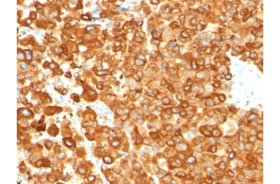 Immunohistochemistry - Anti-Melanoma gp100 Antibody [PMEL/783] - BSA and Azide free (A253150) - Antibodies.com
