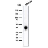 Western Blot - Anti-Melanoma gp100 Antibody [PMEL/783] - BSA and Azide free (A253151) - Antibodies.com