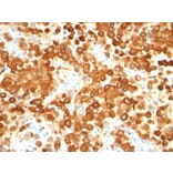 Immunohistochemistry - Anti-Melanoma gp100 Antibody [HMB45 + PMEL/783] - BSA and Azide free (A253151) - Antibodies.com