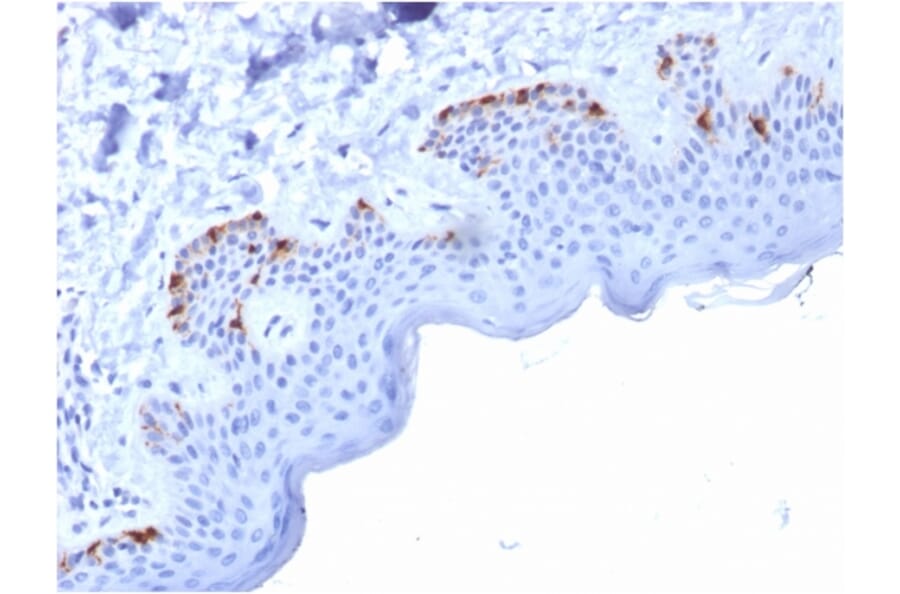 Immunohistochemistry - Anti-Melanoma gp100 Antibody [PMEL/2037] - BSA and Azide free (A253153) - Antibodies.com